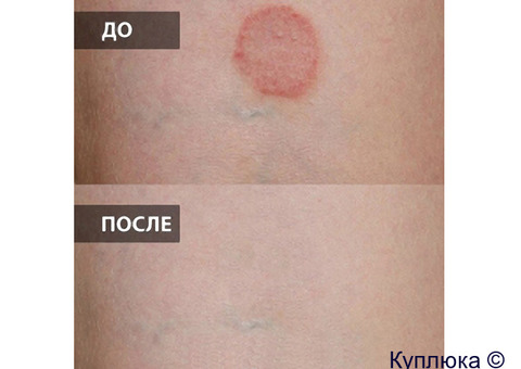 Катушки Мишина с генератором